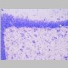 Neuronas Nissl 21.jpg